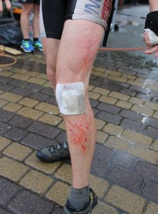 Zdarzały się upadki i drobne kontuzje